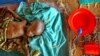 FILE - A malnourished infant lies on the floor in a therapeutic feeding center run by the medical charity Medecins Sans Frontiers in Maradi, southern Niger. 