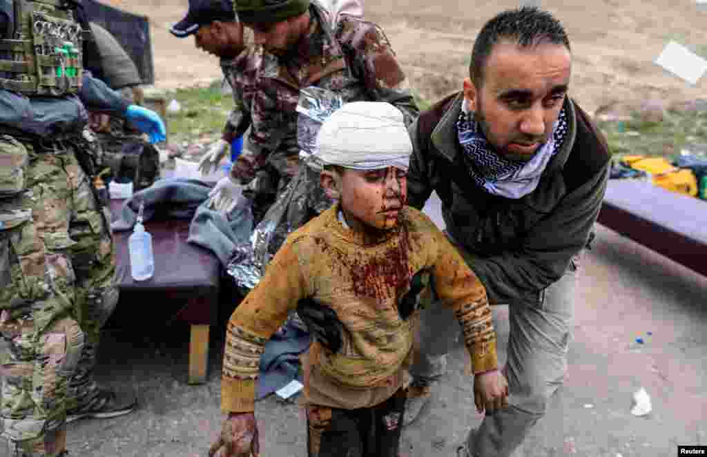 A boy injured in a mortar attack walks toward an ambulance after being treated by medics at a field clinic as Iraqi forces battle Islamic State militants, in western Mosul.