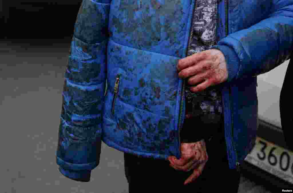 An injured person walks outside Sennaya Ploshchad metro station, following explosions in two train carriages at metro stations in St. Petersburg, Russia.