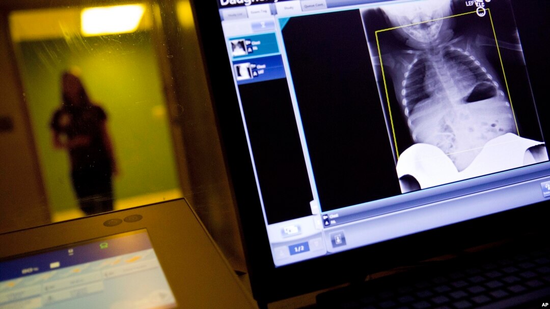 FILE- A radiology technician looks at a chest X-ray at Upson Regional Medical Center in Thomaston, Ga., Feb. 9, 2018. The Trump administration is trying to put an end to surprise medical bills.